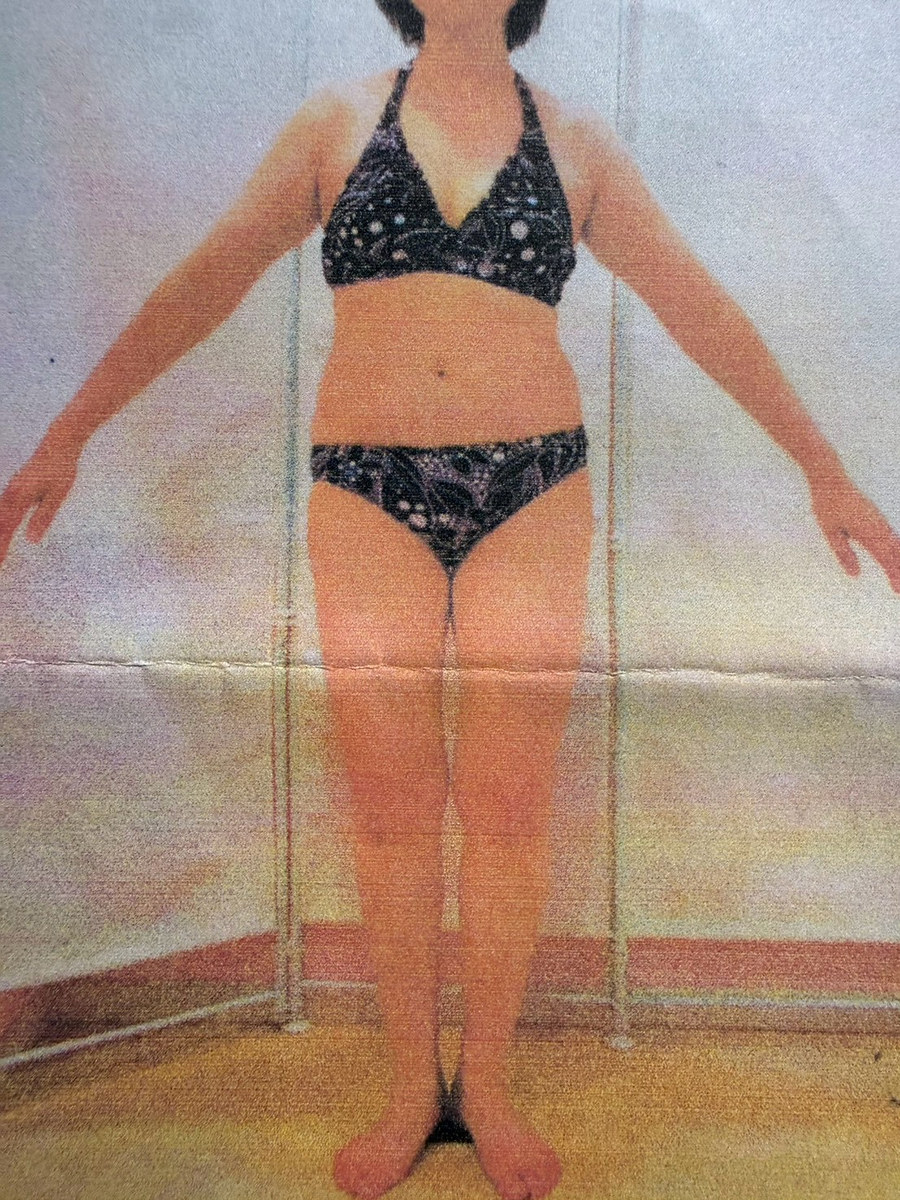 61歳女性 健康増進前（Before）